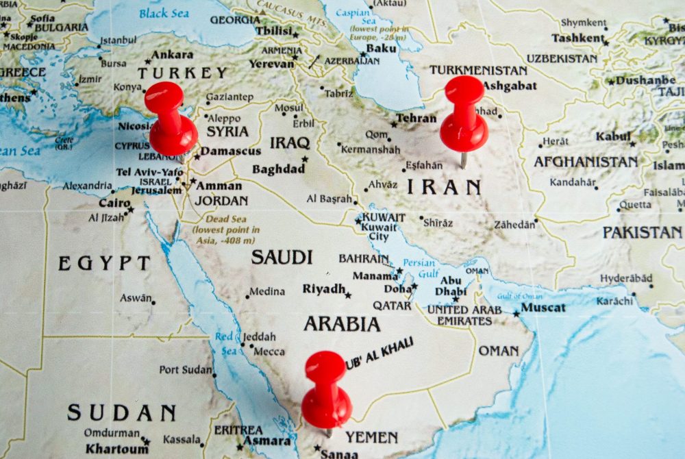 Yemen’de de var aynı sıkıntılar Amerika sürekli bombalıyor bir avuç Yemenli Onur mücadelesi veriyor Filistin Gazze En Büyük Destek veriyorlaryemeni de gündeminize alın